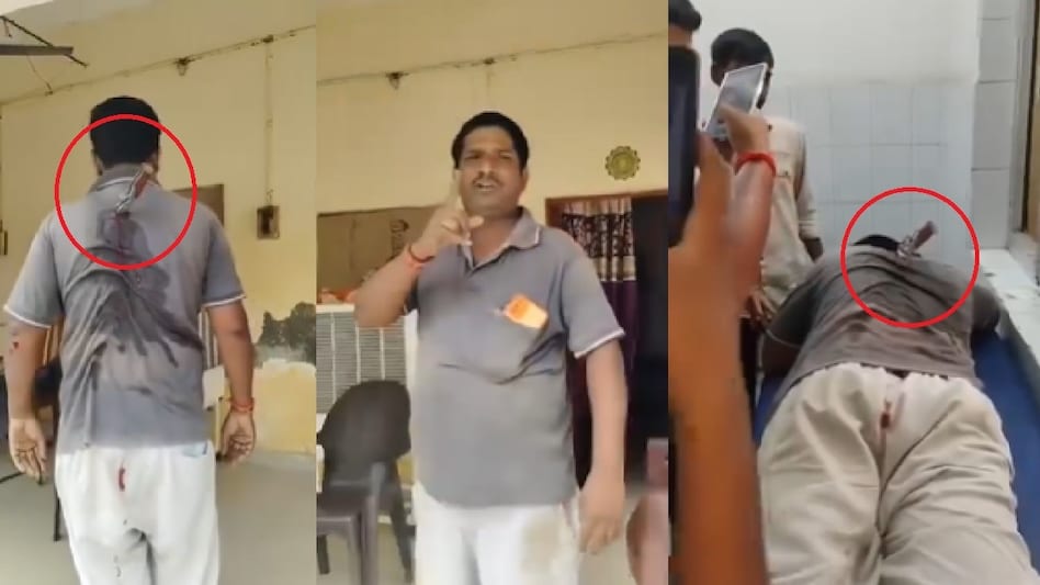 बलिया में युवक की पीठ में घोंपा चाकू, घायल हालत में थाने पहुंचा; पुलिस पर भी लगाए गंभीर आरोप