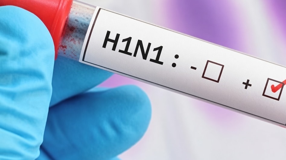 दिल्ली में H1N1 के केस 2600 पार! 24 घंटे में 166 नए मरीज, स्वाइन फ्लू बढ़ने से अस्पताल अलर्ट