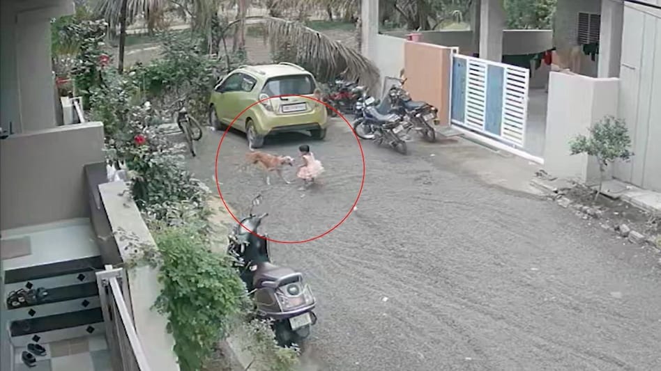 घर के बाहर खेल रही थी 2 साल की बच्ची, अचानक झपटा आवारा कुत्ता; गाल से नोच लिया मांस, ICU में इलाज